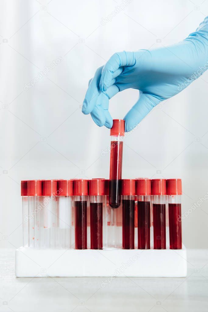 Vitamin & Blood Examination